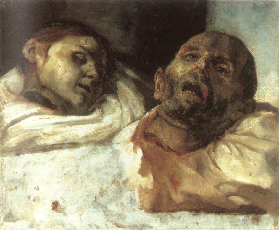Teste mozzate - Théodore Géricault